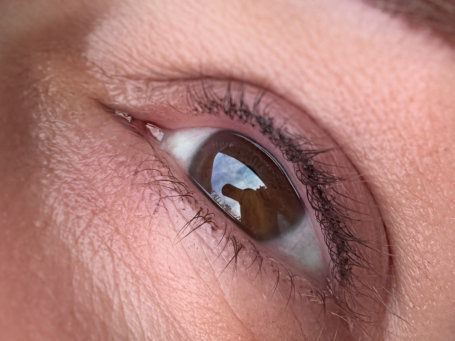 Wimpernkranzverdichtung Bodensee Malibu Ink